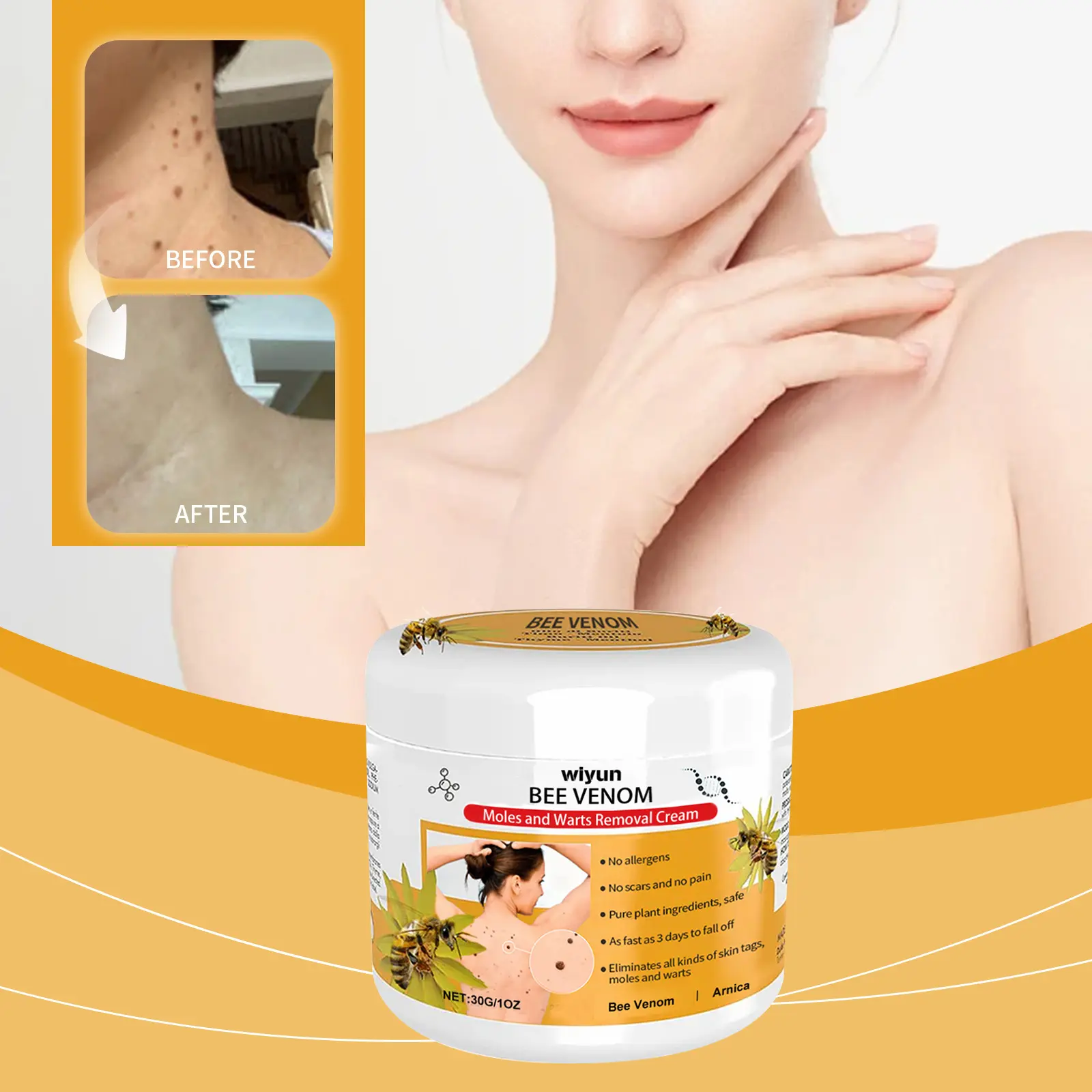 Bee Venom Wart Treatment Cream Gentle Cleansing Skin Flesh G