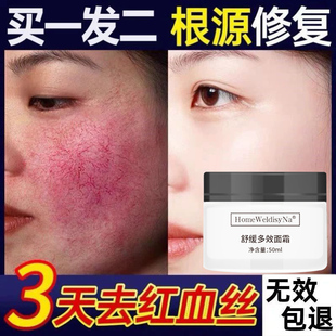 去除红血丝过敏增厚角质层敏感肌肤修复改善高原红激素脸部泛红