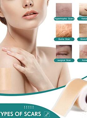 2025新款硅胶疤痕淡化妊娠修复贴透气防水手术伤痕美容淡化疤痕贴
