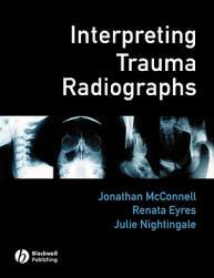 【预售】Interpreting Trauma Radiographs