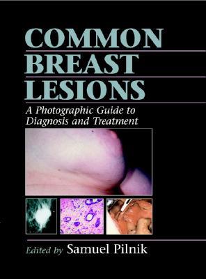 【预售】英文原版Common Breast Lesions: A Photographic Guide to进口图书