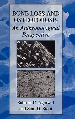 【预售】Bone Loss and Osteoporosis: An Anthropological