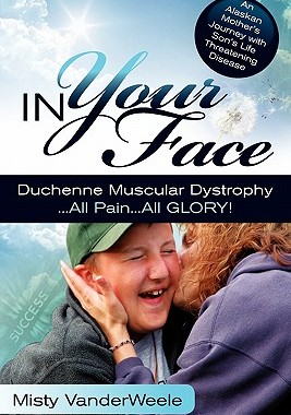 【预售】In Your Face Duchenne Muscular Dystrophy All Pain