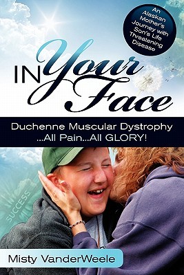 【预售】In Your Face Duchenne Muscular Dystrophy All Pain