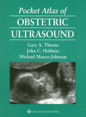 【预订】Pocket Atlas of Obstetric Ultrasound