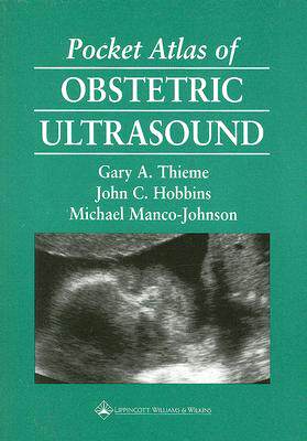 【预订】Pocket Atlas of Obstetric Ultrasound