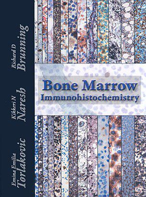 【预订】Bone Marrow IHC