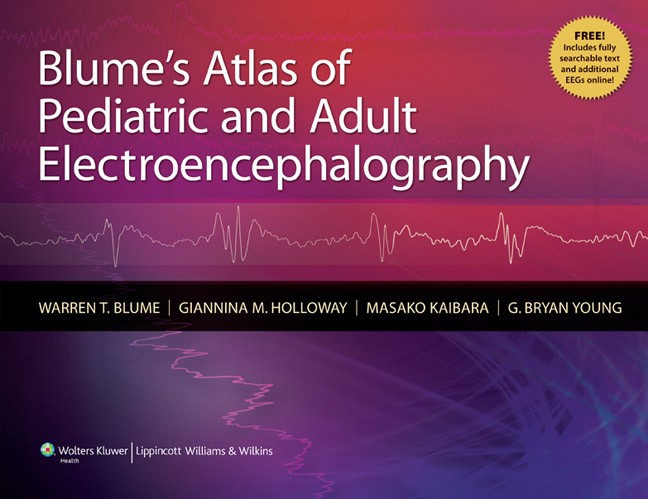 【预订】Blume's Atlas of Pediatric and Adult Electroencephalography