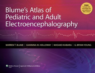 Atlas Adult 预订 Electroencephalography and Blume Pediatric