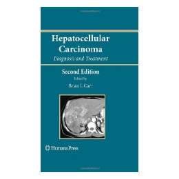 【预售】Hepatocellular Carcinoma: Diagnosis and Treatment
