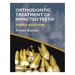 【预售】orthodontic treatment of impacted teeth 3e