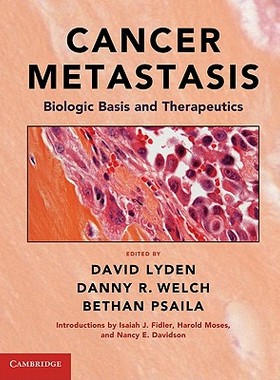 【预售】Cancer Metastasis: Biologic Basis and Therapeutics