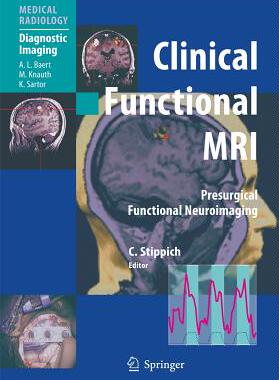 【预售】Clinical Functional MRI: Presurgical Functional