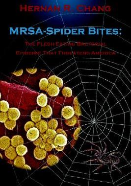【预售】Mrsa - Spider Bites: The Flesh-Eating Bacterial