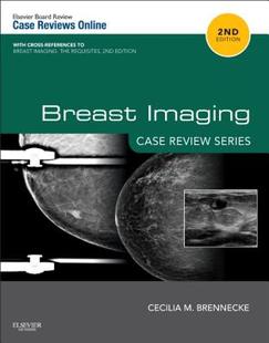 预售 Review Breast Case Series Imaging