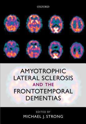 【预售】Amyotrophic Lateral Sclerosis and the Frontotemporal