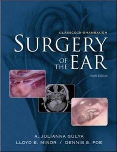 Shambaugh Ear Glasscock the Surgery 预售
