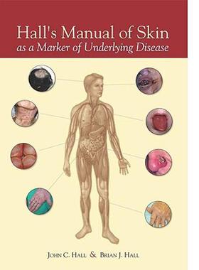 【预售】Hall's Manual of Skin as a Marker of Underlying
