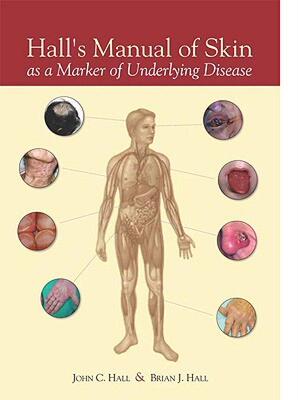 【预售】Hall's Manual of Skin as a Marker of Underlying