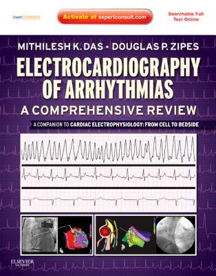 【预售】Electrocardiography of Arrhythmias: A Comprehensive