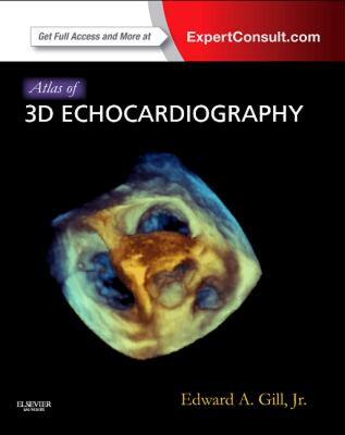 【预售】Atlas of 3D Echocardiography: Expert Consult -