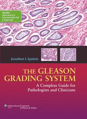 【预售】The Gleason Grading System: A Complete Guide for