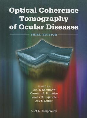 【预售】Optical Coherence Tomography of Ocular Diseases