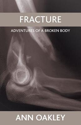 【预售】Fracture: Adventures of a Broken Body