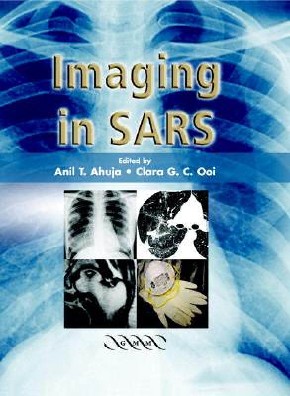 【预售】Imaging in Sars