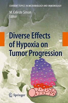 【预售】Diverse Effects of Hypoxia on Tumor Progression