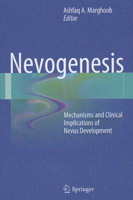 【预售】Nevogenesis: Mechanisms and Clinical Implications of