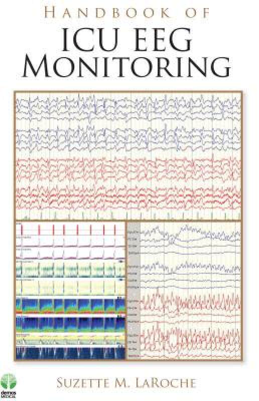 【预售】Handbook of ICU EEG Monitoring