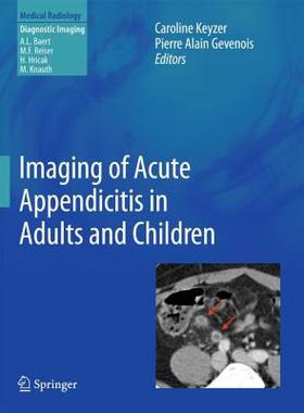 【预售】Imaging of Acute Appendicitis in Adults and