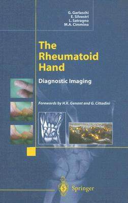 【预售】The Rheumatoid Hand: Diagnostic Imaging