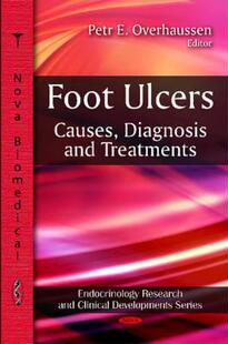 Ulcers Foot 预售 Treatment Diagnosis and Causes