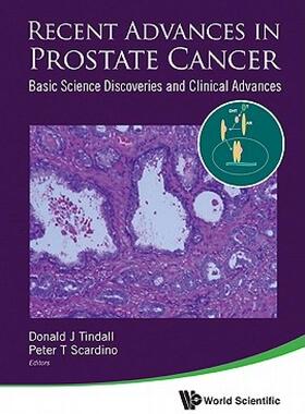 【预售】Recent Advances in Prostate Cancer: Basic Science