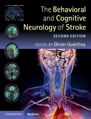 【预售】The Behavioral and Cognitive Neurology of Stroke