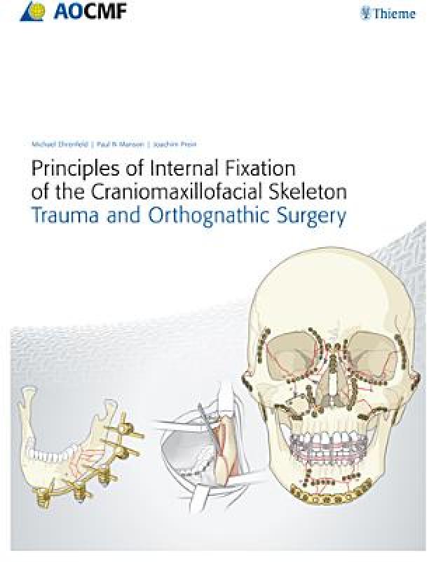 【预售】Principles of Internal Fixation of the