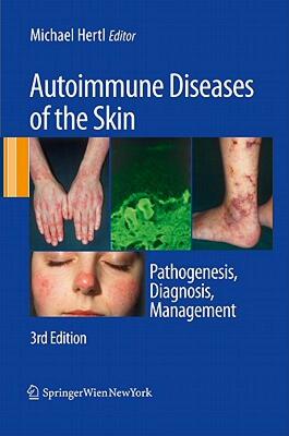 【预售】Autoimmune Diseases of the Skin: Pathogenesis