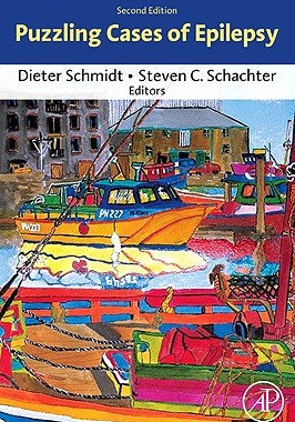 【预售】Puzzling Cases of Epilepsy