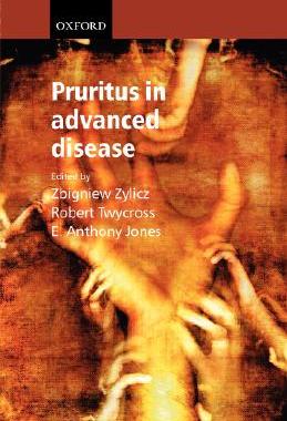 【预售】Pruritus in Advanced Disease