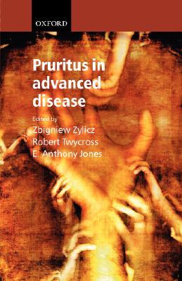 【预售】Pruritus in Advanced Disease