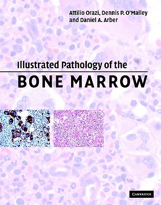 【预售】Illustrated Pathology of the Bone Marrow