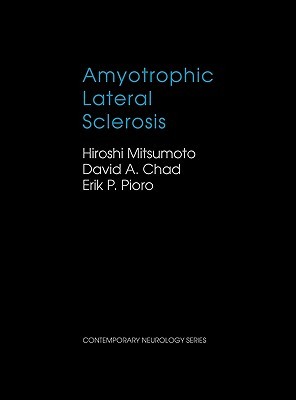 【预售】Amyotrophic Lateral Sclerosis