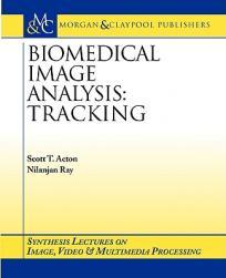 【预售】Biomedical Image Analysis: Tracking