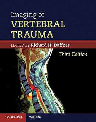 【预售】Imaging of Vertebral Trauma