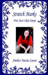 【预售】Stretch Marks - Not Just Skin Deep