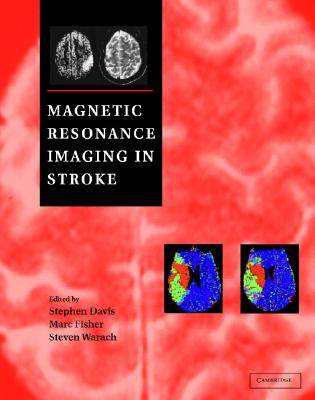 【预售】Magnetic Resonance Imaging in Stroke