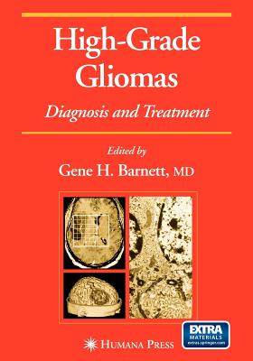【预售】High-Grade Gliomas: Diagnosis and Treatment