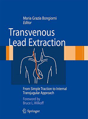 【预售】Transvenous Lead Extraction: From Simple Traction to